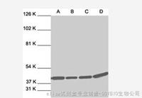 Western Blot  彩虹 预染蛋白质分子量标准（窄谱，2-73kDa）