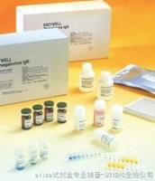 人髓磷脂碱性蛋白 	MBPELISA试剂盒