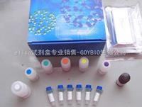裸鼠甲种胎儿球蛋白/甲胎蛋白 ELISA试剂盒
