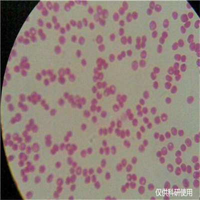 乙型溶血性链球菌