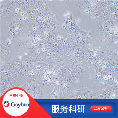 WPMY-1 (人正常前列腺基质永生化细胞)